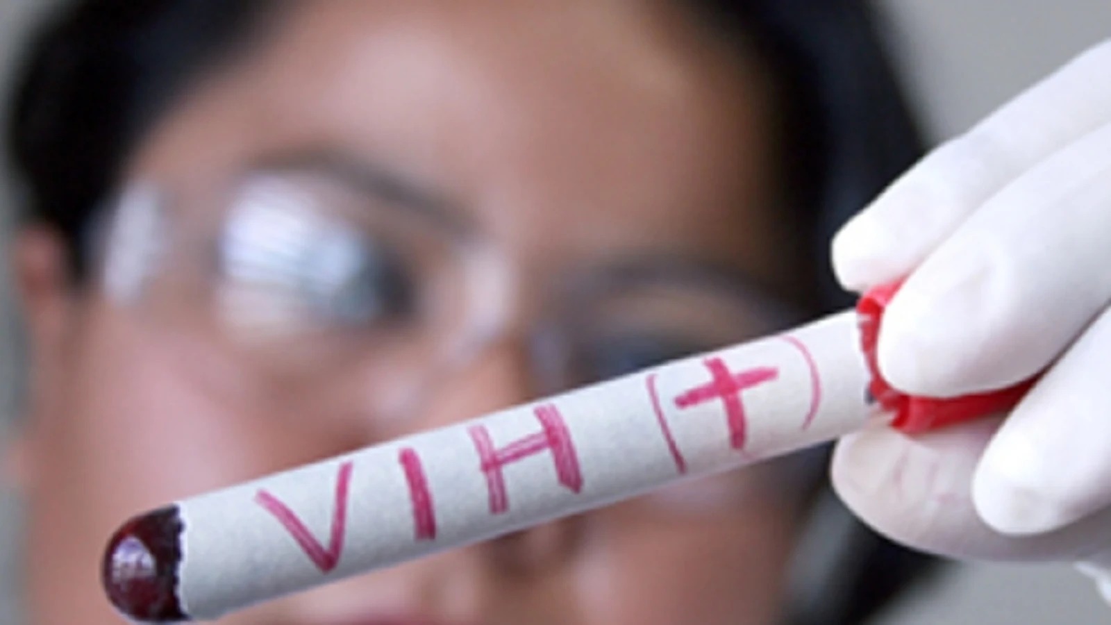 Estudio VIH